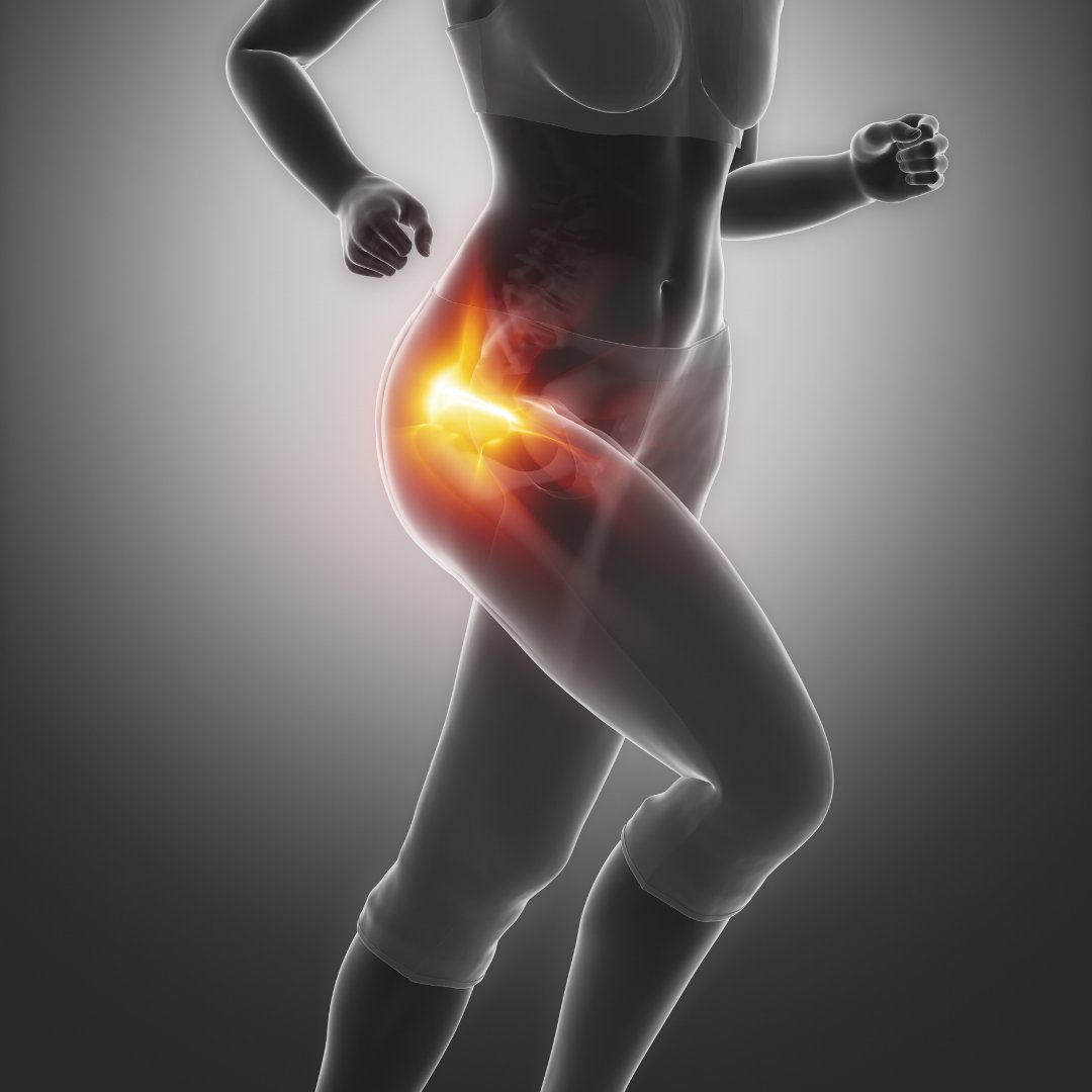 Illustration of a runner with the hip joint highlighted for the Comfyorthopedic hip brace collection.