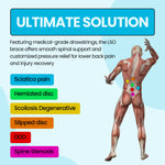 LSO Lumbar Back Brace for Sciatica, Scoliosis, Herniated discs & Lower Back Pain L0648/ L0631 - Comfyorthopedic